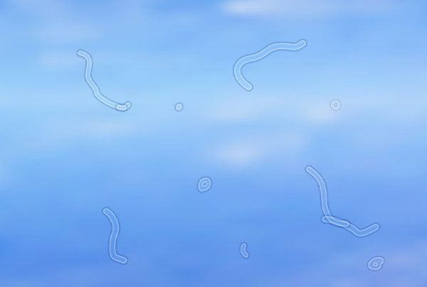 Flashes and Floaters